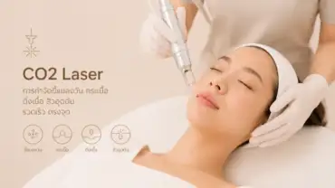 CO2 Laser