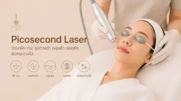 Picosecond Laser