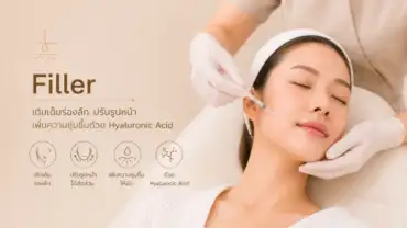 ฟิลเลอร์ (Filler)
