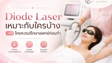 Diode Laser เหมาะกับใครบ้าง และใครควรปรึกษาแพทย์ก่อนทำ