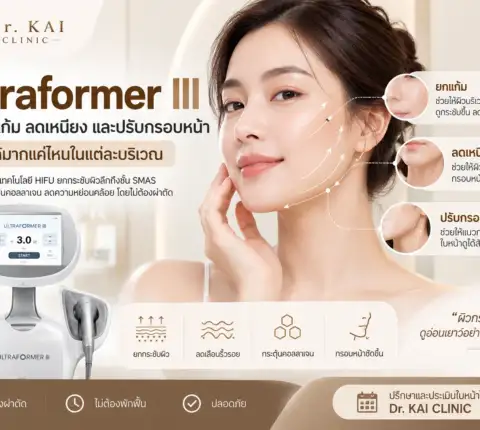 Ultraformer III ช่วยยกแก้ม ลดเหนียง และปรับกรอบหน้าได้มากแค่ไหนในแต่ละบริเวณ
