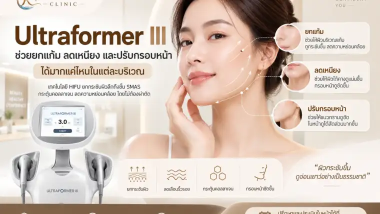 Ultraformer III ช่วยยกแก้ม ลดเหนียง และปรับกรอบหน้าได้มากแค่ไหนในแต่ละบริเวณ